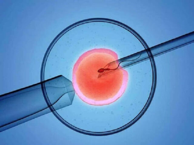 重庆借卵试管哪里找-三次体外蜕膜的成功率，科学研究的一个重要指标